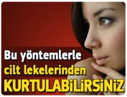 İşte Çare